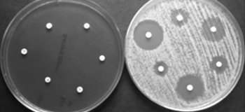 Método microbilógico para evaluar la resistencia a antimicrobianos (RAM) por difusión de sensidiscos: Experiencia de CCAYAC en el External Quality Control System (EQAS) 2018